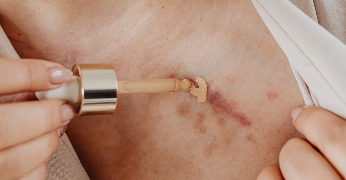 Mikroślady, wielka zmiana: roślinne serum, które krok po kroku wygładza blizny atroficzne